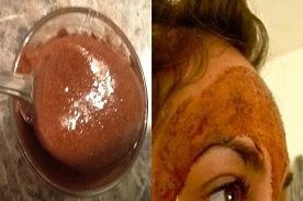 ''PANCHASOOTRA – FIVE SURESHOTS FOR COLD INDUCED HEADACHES''